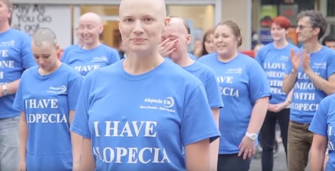 Alopecia UK Flash Mob