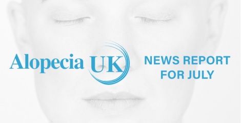 Alopecia Uk News Review for July