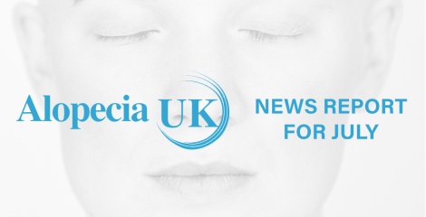 Alopecia Uk News Review for July