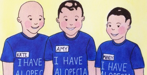 Children with Alopecia