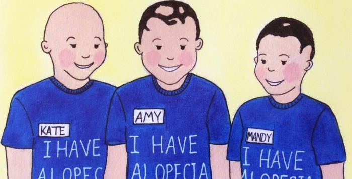 Children with Alopecia