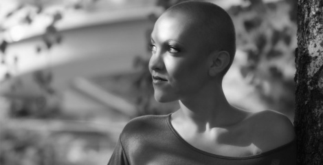 What is Alopeica? And other forms of hairloss