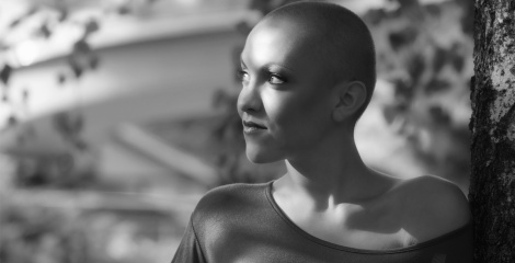 What is Alopeica? And other forms of hairloss
