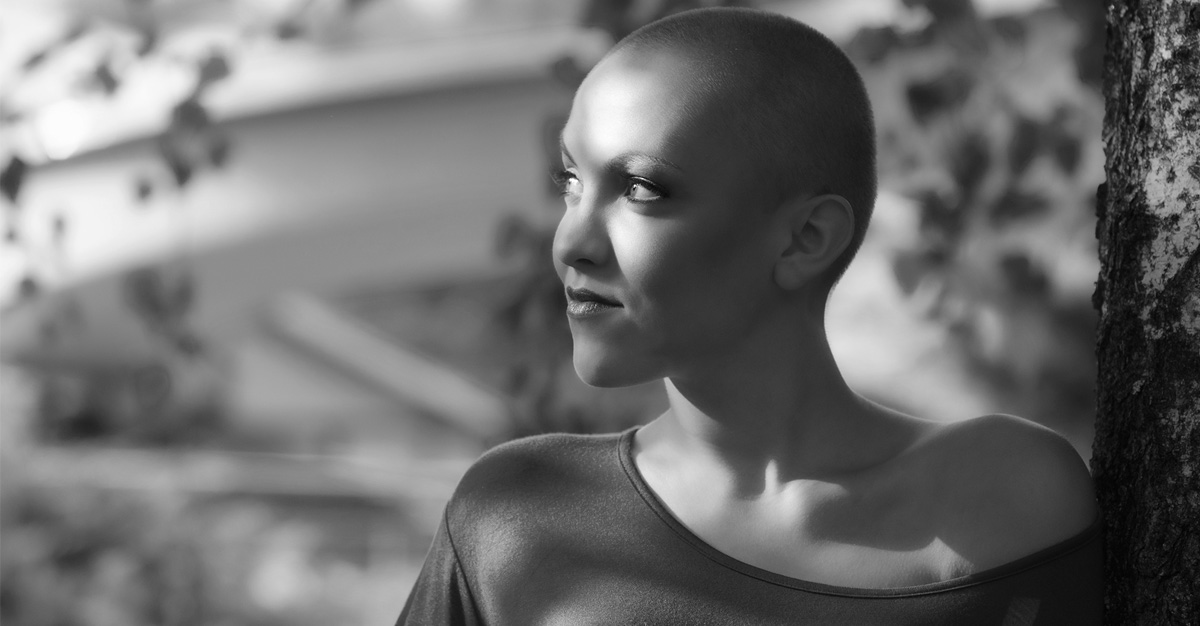 What is Alopeica? And other forms of hairloss