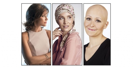 Wigs, Turbans or Going Bald?