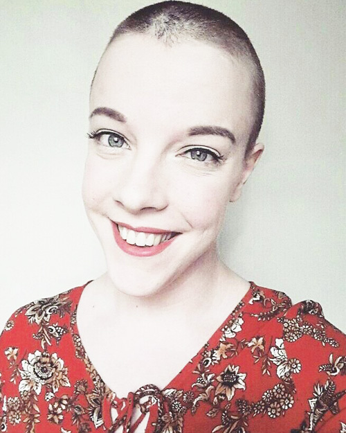Talking trichotillomania