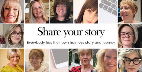 Share your hair loss story