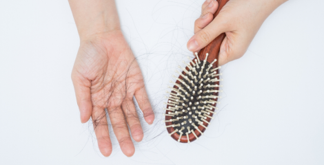 Hair Loss During Menopause