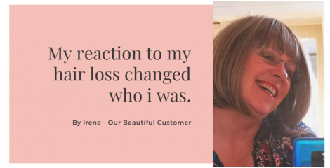 My reaction to my hair loss changed who I was.