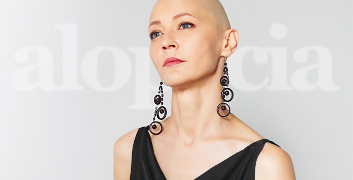 The Complete Guide to Alopecia Types