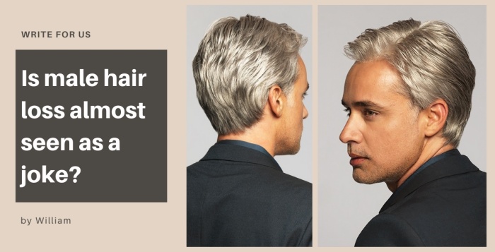 Is Male Hair Loss Almost Seen as a Joke?