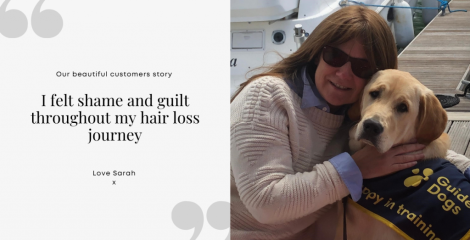 Should I feel guilt throughout my hair loss journey?