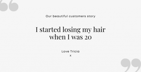 I started losing my hair when I was 20.