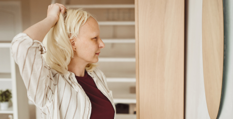Coming to Terms with Frontal Fibrosing Alopecia
