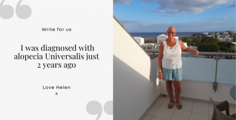 I was diagnosed with alopecia Universalis just 2 years ago