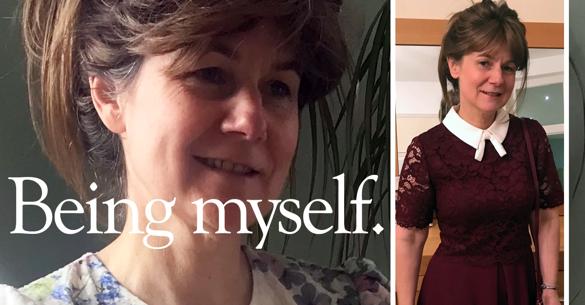 My personal hair loss story