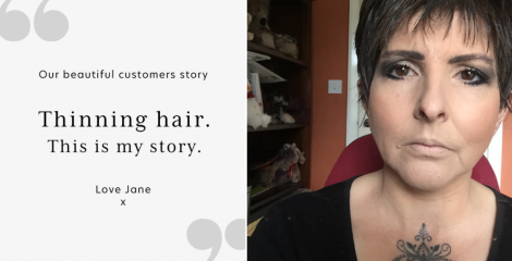 Thinning hair, this is my story.