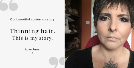 Thinning hair, this is my story.