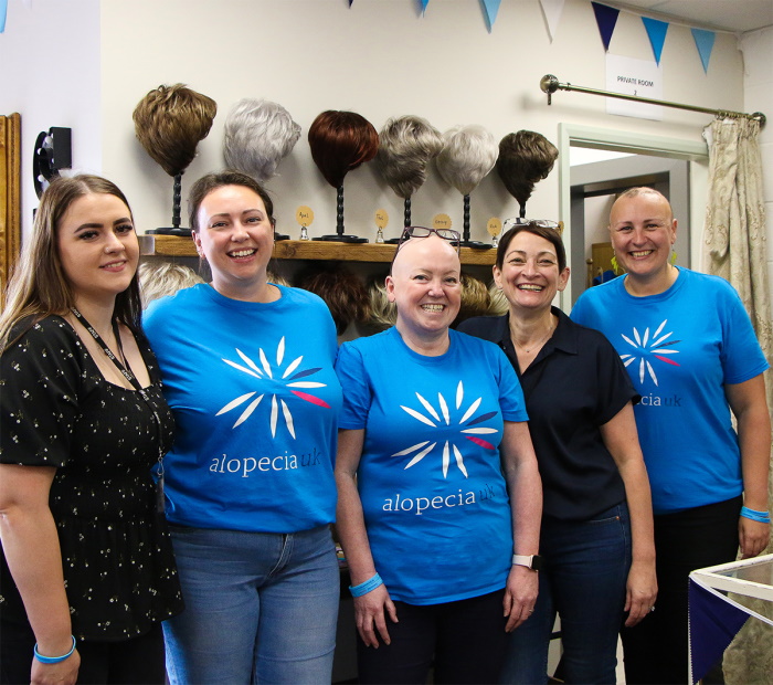 Alopecia UK and Simply Wigs team photo at the shop, highlighting their partnership in supporting people experiencing hair loss.