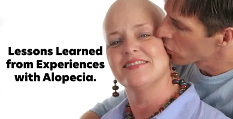 Lessons Learned from Experiences with Alopecia