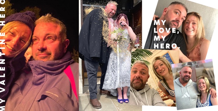 My hair loss and my valentine hero