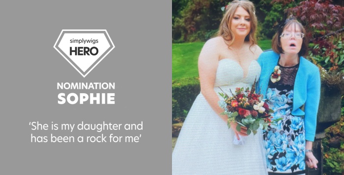 I am a transgender woman, I lost my hair in my early thirties