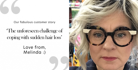 The unforeseen challenge of coping with sudden hair loss