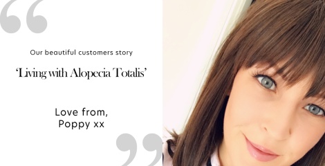 Living with Alopecia Totalis