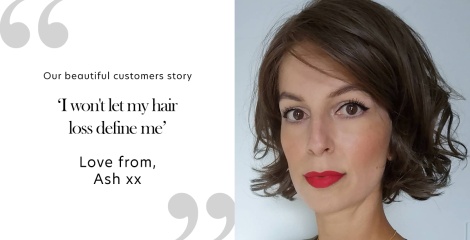 I won’t let my hair loss define me