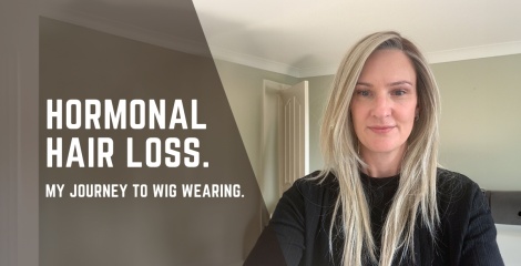 Hormonal hair loss