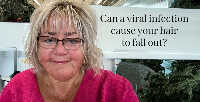 Can a viral infection cause your hair to fall out?