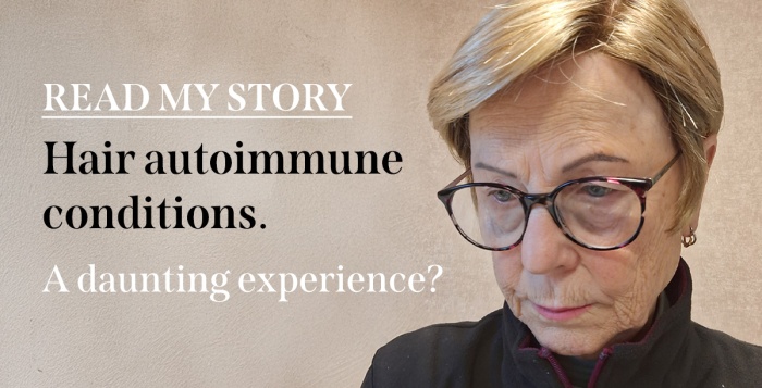 Hair autoimmune conditions | A daunting experience?
