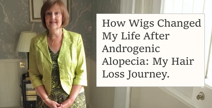 How Wigs Changed My Life After Androgenic Alopecia: My Hair Loss Journey