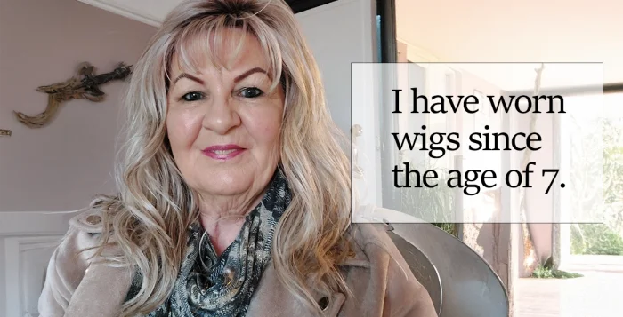 I have worn wigs since the age of 7