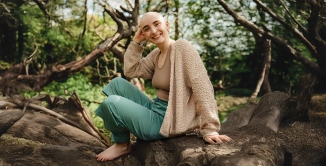 Hair Loss, Yoga and My Very Rare Hair Condition