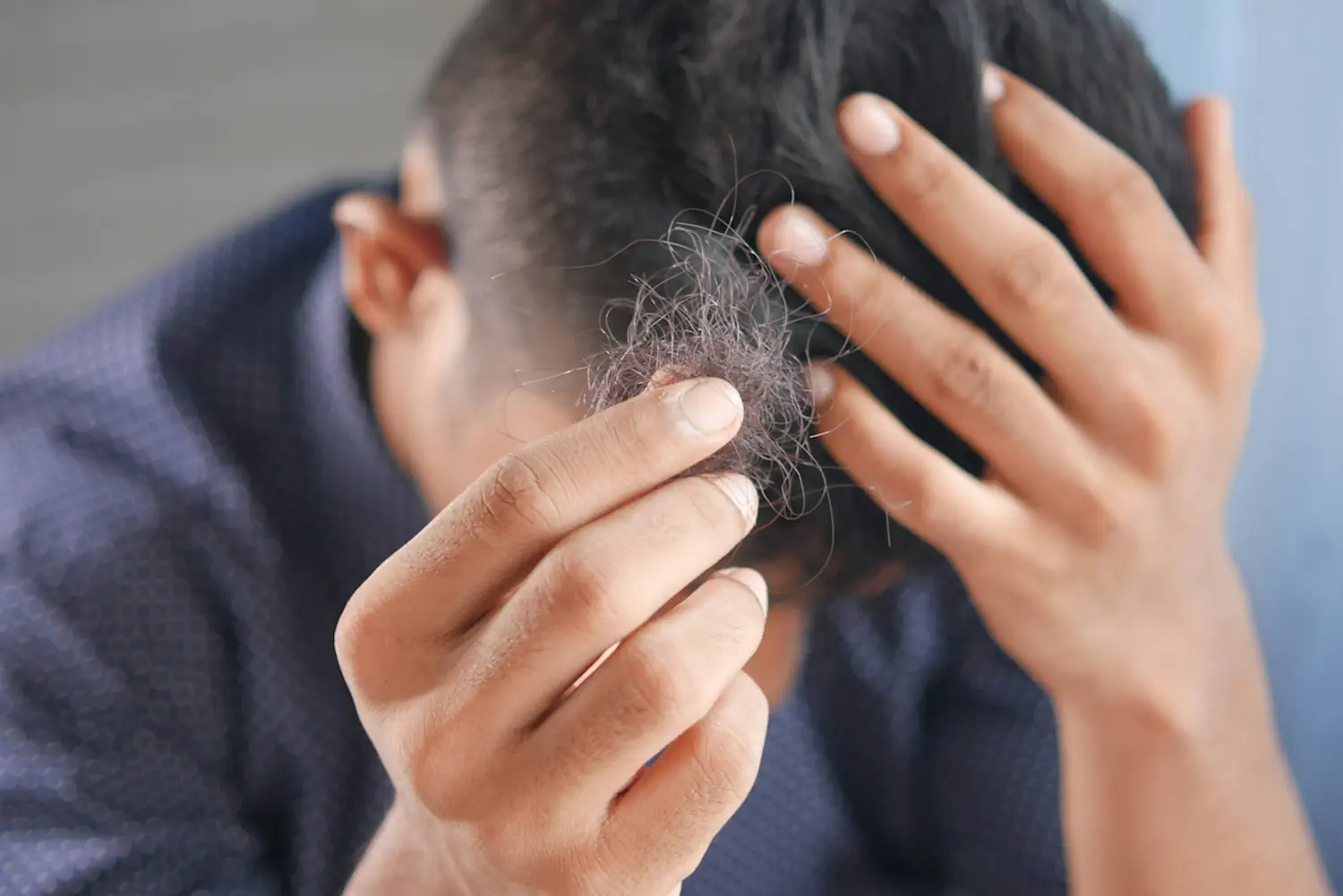 A person deals with stress-related hair loss. One hand holds their head and the other holds a tuft of hair.