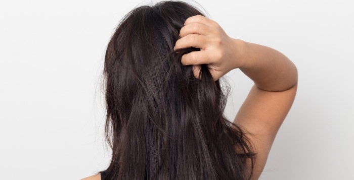 Why Is My Wig Itching? Reasons and Solutions