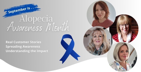 Alopecia Awareness Month: Sharing Stories, Spreading Understanding