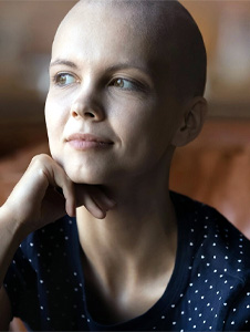 alopecia-information-hub