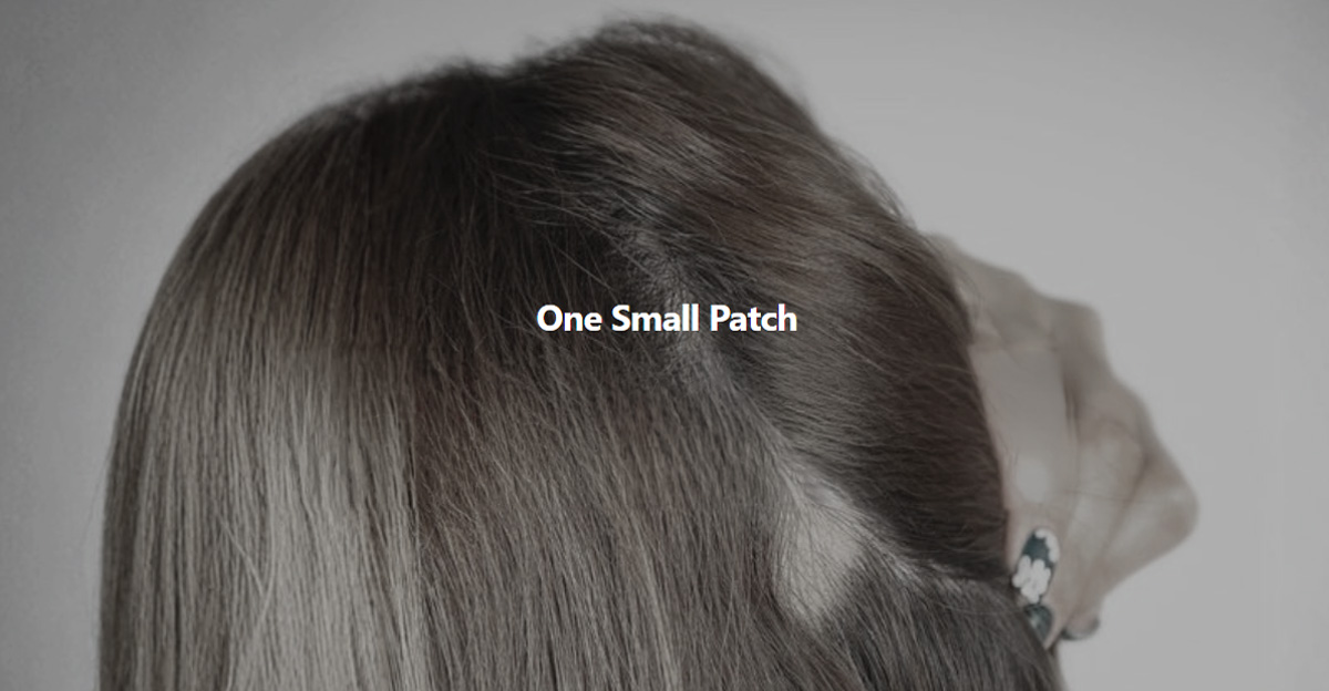 alopecia-patch