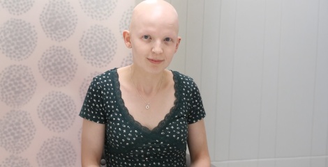 Alopecia Totalis: Symptoms, Hair Loss, Treatment & Support