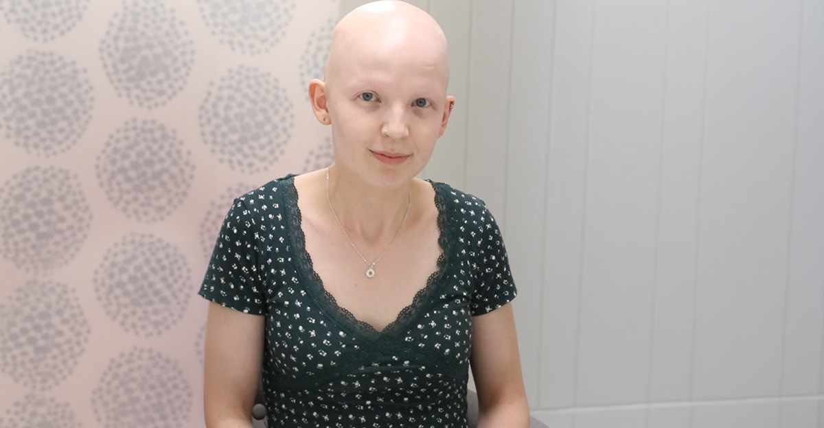 alopecia-totalis-syptoms-
