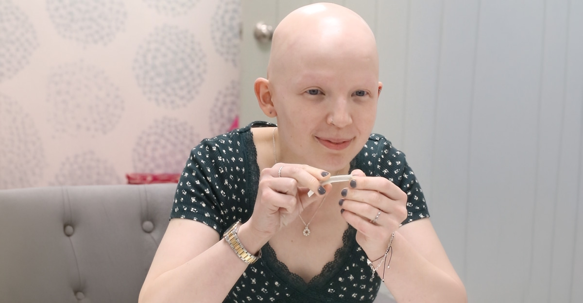alopecia-totallis-wig-shop