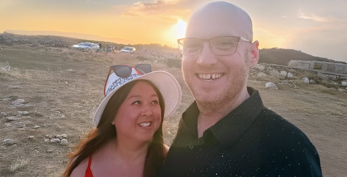 My Battle With Alopecia: My Hair Loss Journey
