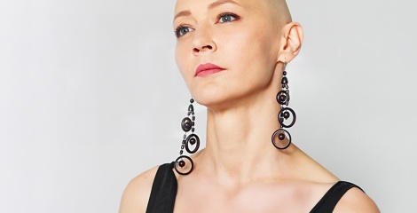 The Complete Guide to Alopecia: Types, Causes and Wigs for Hair Loss
