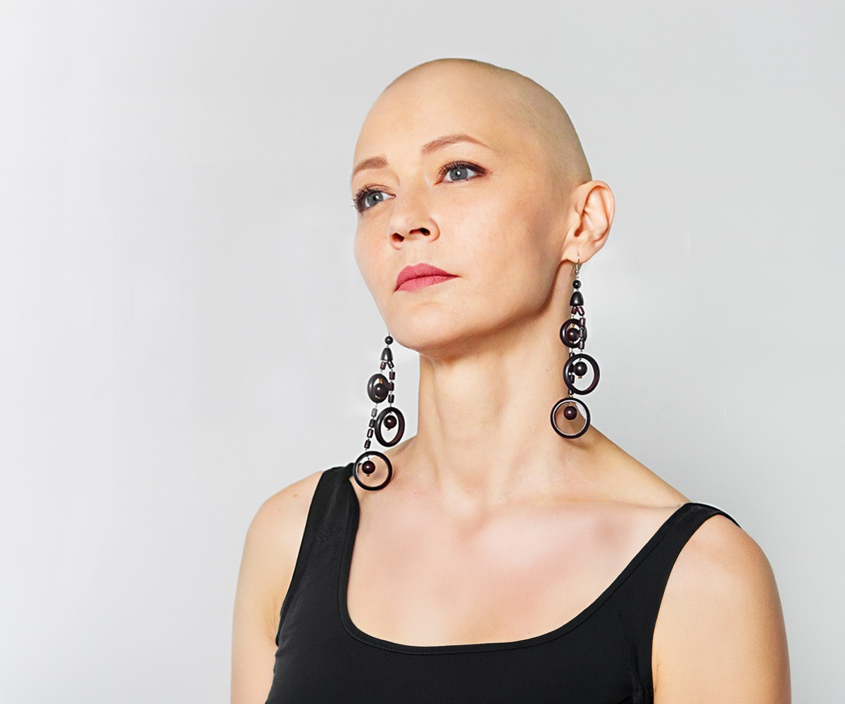 A person with alopecia totalis