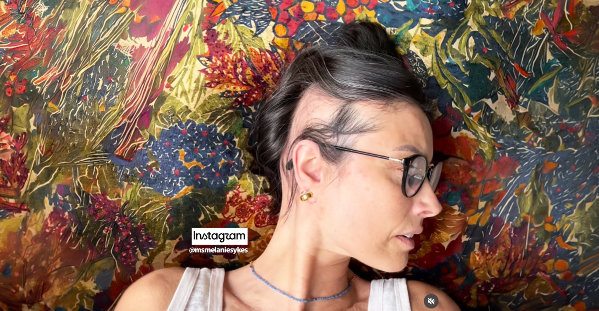 melanie-sykes-alopecia-on-instagram
