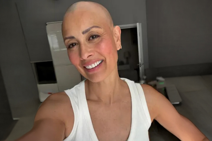 melanie-sykes-alopecia