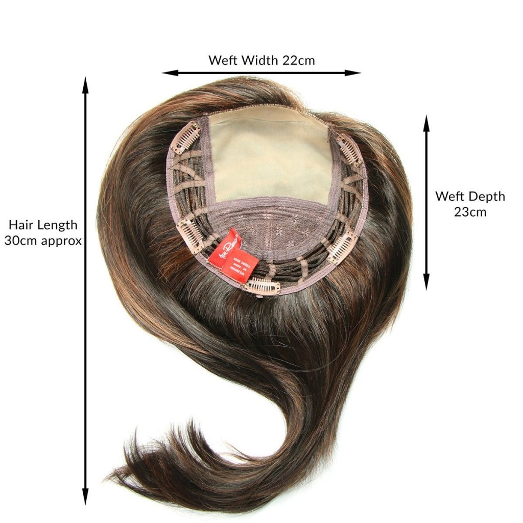stage 3 hairloss